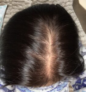 分け目の薄い女性③