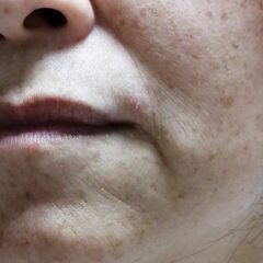 小じわが気になる方、肌の弱い方、男性でもお肌のケアは必要ですよ！！