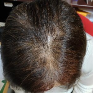 シャンプー　コンディショナーを使用前