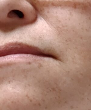 女性の小じわ顔