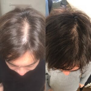 40歳HG様髪の写真