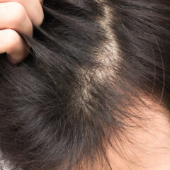 髪に栄養！馬油配合の養毛料で髪のお悩み解決。